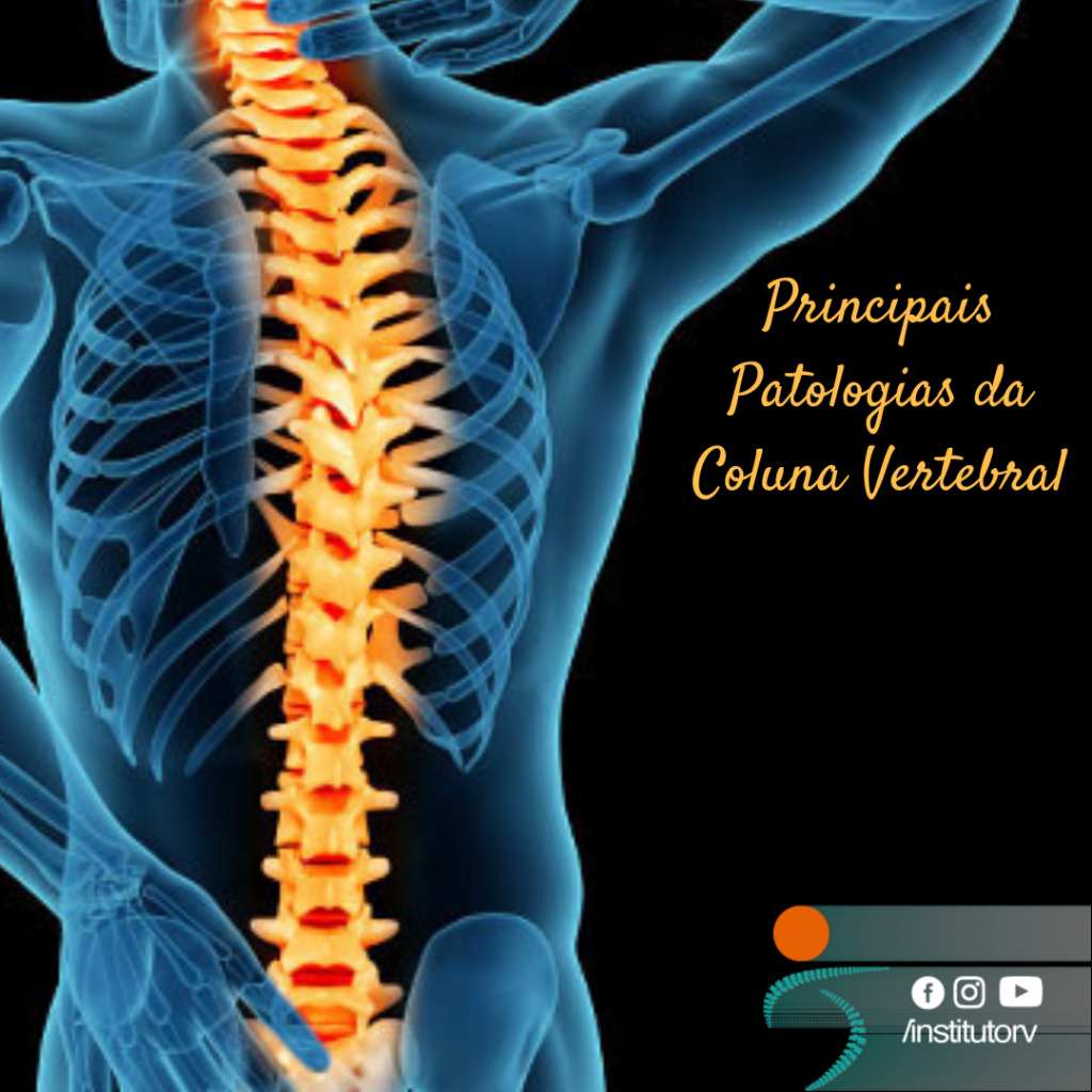 Principais patologias da Coluna