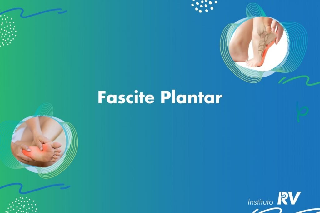 Fascite Plantar em Porto Alegre