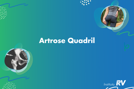 Artrose quadril fisioterapia
